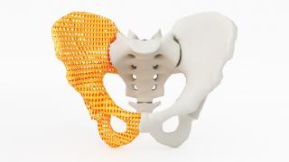 3d printed pelvis bone